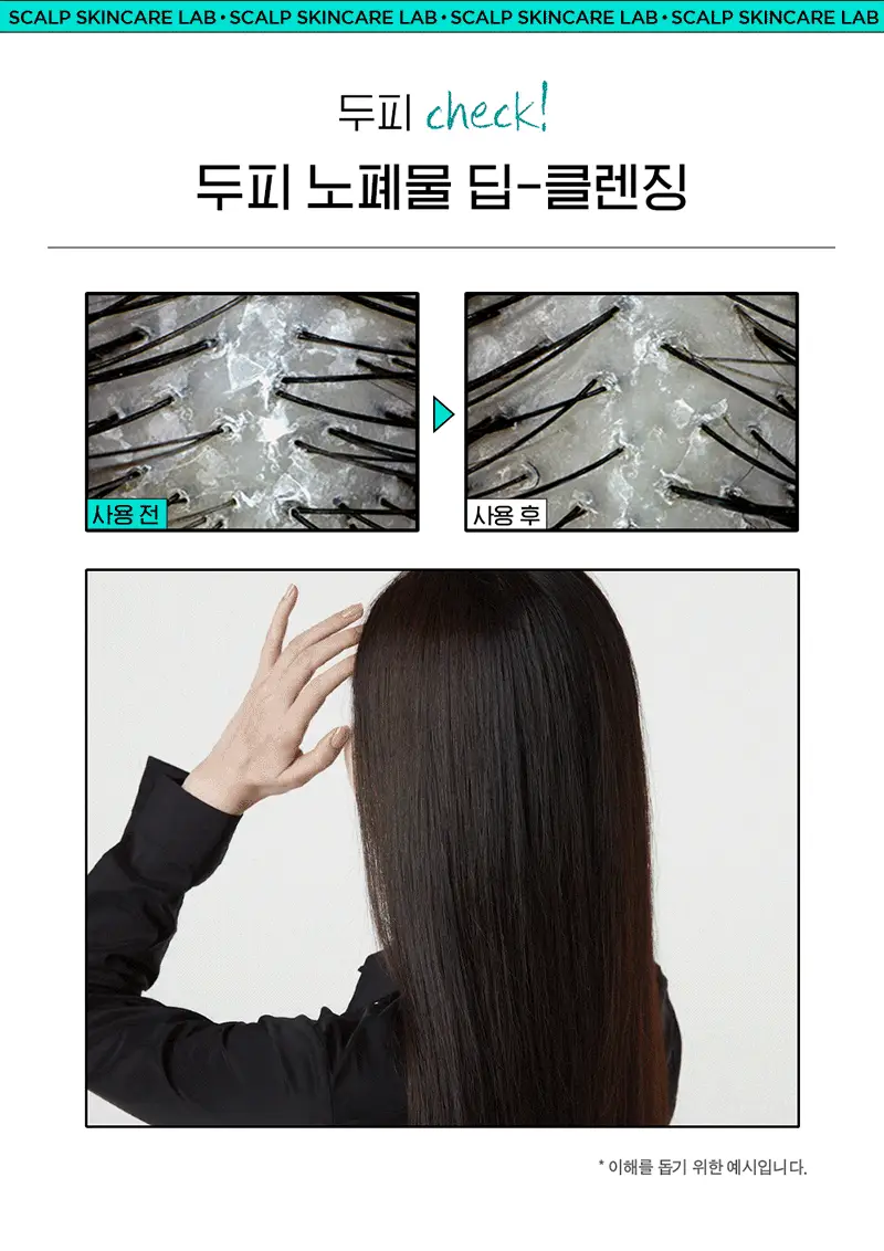 [각질/가려움/저자극] 라보에이치 댄드러프클리닉 워터스케일러 250ML 탈모증상완화 상세페이지 11